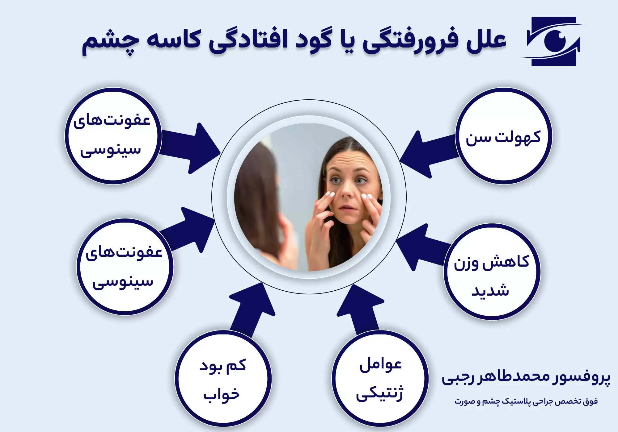 علت گود افتادگی کاسه چشم