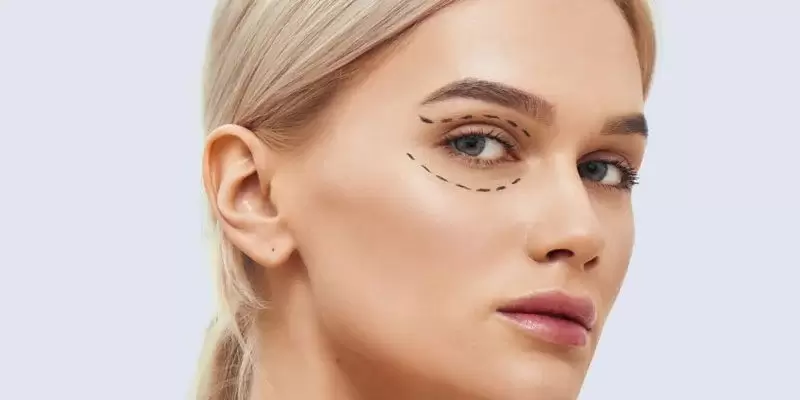 مراقبت های بعد از عمل ترمیمی